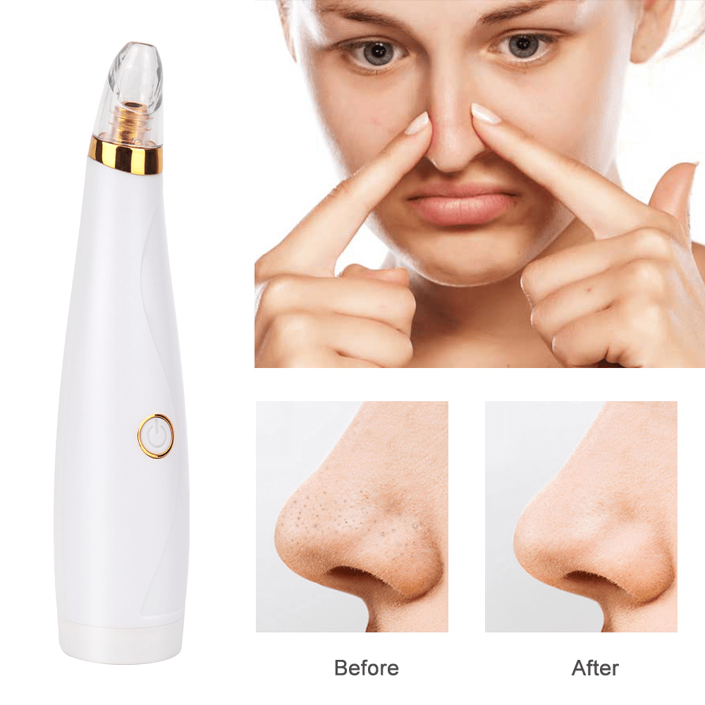 Blackhead Remover Face Acne