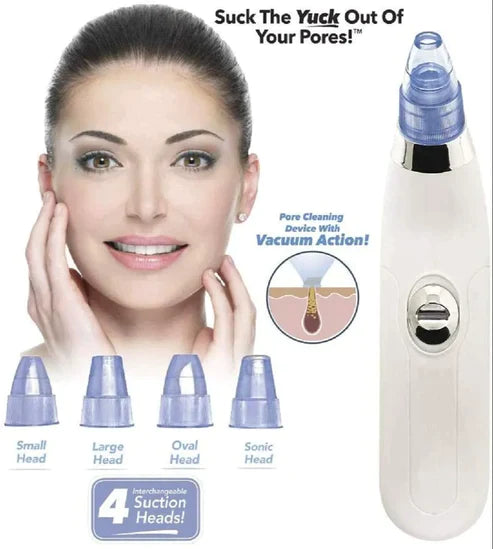 4 in 1 Derma Vacuum Suction Blackhead/Acne/Oil/Pore Cleaner